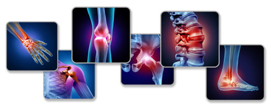 7 Proven Strategies for PEA Pain Relief for Osteoarthritis, Sciatica, Nerve Pain, and Fibromyalgia